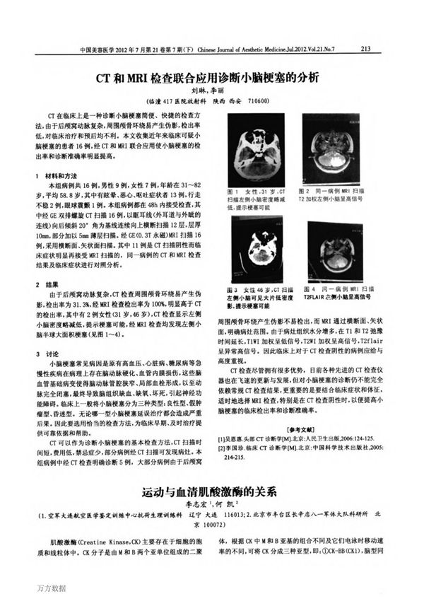 CT和MRI检查联合应用诊断小脑梗塞的分析