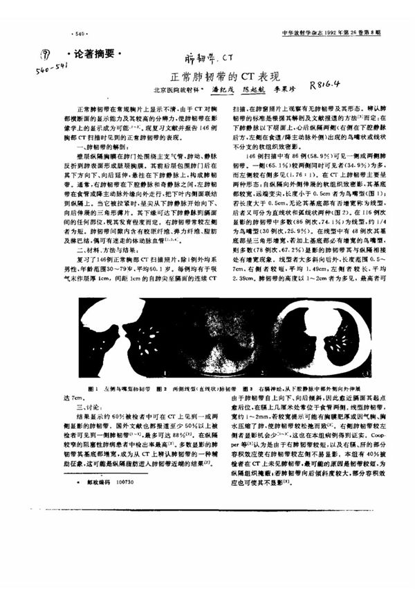 正常肺韧带的CT表现