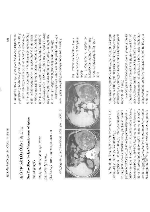 脾脏巨大良性间叶瘤1例报告