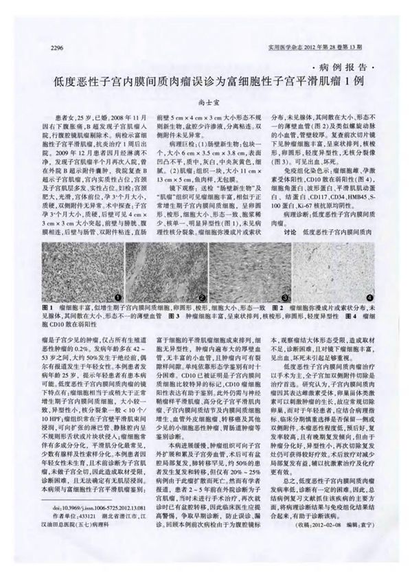 低度恶性子宫内膜间质肉瘤误诊为富细胞性子宫平滑肌瘤1例