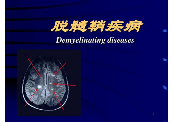 多发性硬化 ppt 脱髓鞘疾病