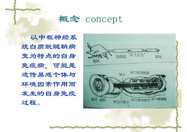 多发性硬化(PPT)