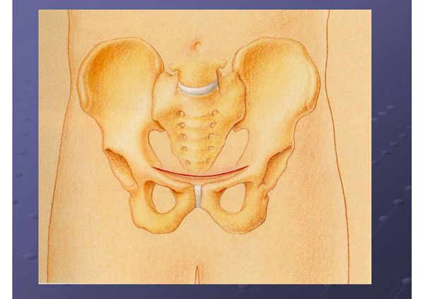 骨盆骨折(精品-PPT)