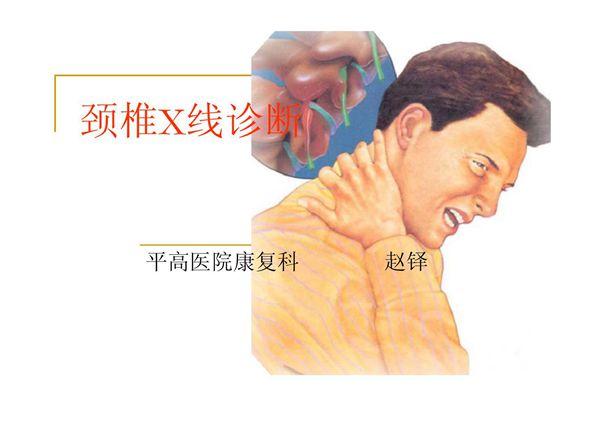 颈椎X线诊断-课件(PPT演示)